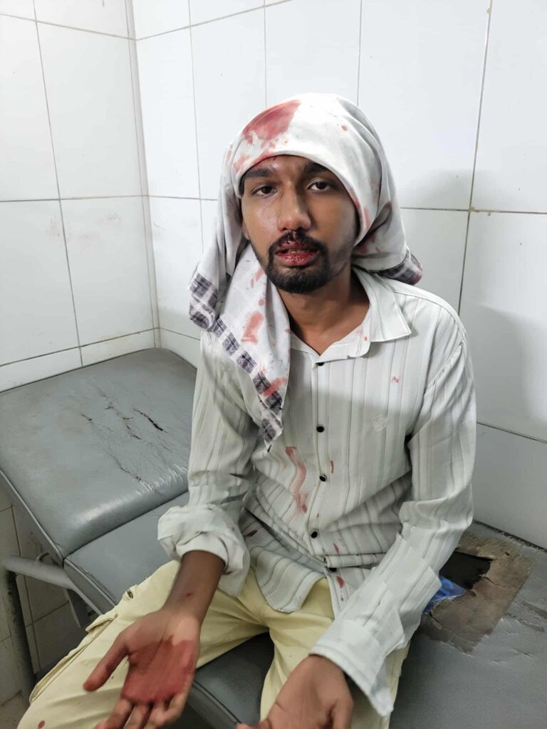 আটঘরিয়ায় ছিনতাইকারীর ছুরিকাঘাতে যুবক গুরুতর আহত